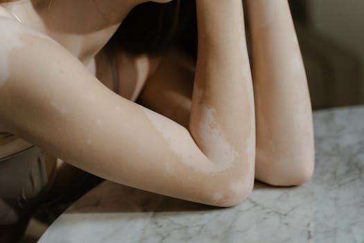 A close-up image showcasing vitiligo on a woman's arms, highlighting skin diversity and self-love.